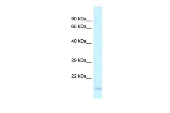 LY96 Rabbit Polyclonal Antibody
