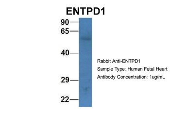 ENTPD1 Rabbit Polyclonal Antibody