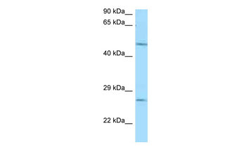 Entpd1 Rabbit Polyclonal Antibody