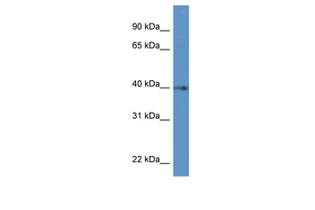 PTGDR Rabbit Polyclonal Antibody