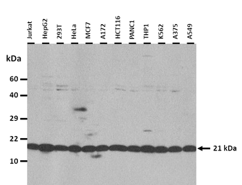 CD70 Rabbit Polyclonal Antibody
