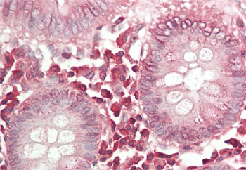 TNFAIP3 Rabbit Polyclonal Antibody