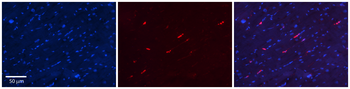 S100A8 Rabbit Polyclonal Antibody