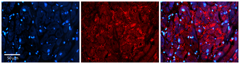 S100A8 Rabbit Polyclonal Antibody