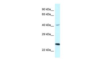 CD244 Rabbit Polyclonal Antibody