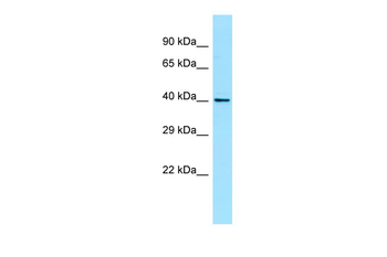 WNT8A Rabbit Polyclonal Antibody