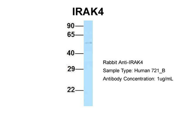 IRAK4 Rabbit Polyclonal Antibody
