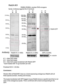 RAB2A Rabbit Polyclonal Antibody