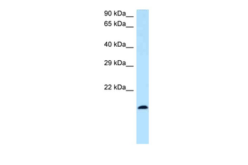BST2 Rabbit Polyclonal Antibody