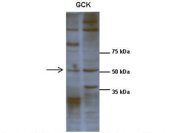 GCK Rabbit Polyclonal Antibody
