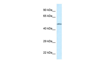 GCK Rabbit Polyclonal Antibody