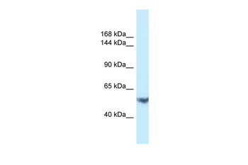 EPHA1 Rabbit Polyclonal Antibody