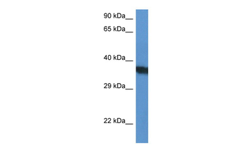 SURF1 Rabbit Polyclonal Antibody