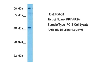 PRKAR2A Rabbit Polyclonal Antibody