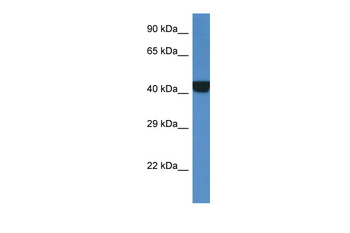 PRKAR2A Rabbit Polyclonal Antibody