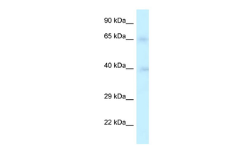 RFC2 Rabbit Polyclonal Antibody