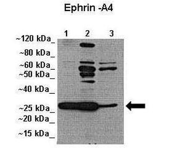 EFNA4 Rabbit Polyclonal Antibody