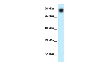 NVL Rabbit Polyclonal Antibody