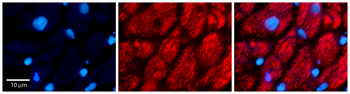 CALU Rabbit Polyclonal Antibody