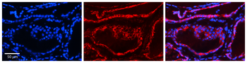 CALU Rabbit Polyclonal Antibody