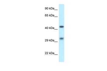 SCARB2 Rabbit Polyclonal Antibody