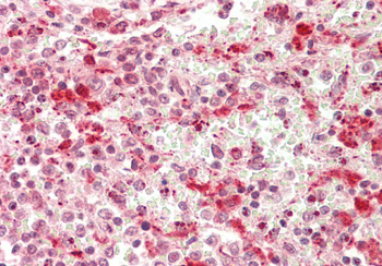 EIF3A Rabbit Polyclonal Antibody