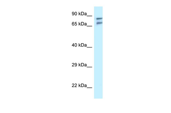 TNIP1 Rabbit Polyclonal Antibody