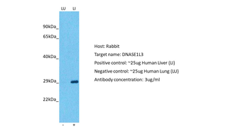 DNASE1L3 Rabbit Polyclonal Antibody