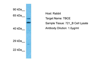 TBCE Rabbit Polyclonal Antibody