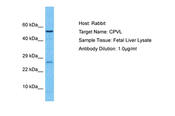 CPVL Rabbit Polyclonal Antibody