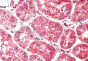 CPVL Rabbit Polyclonal Antibody