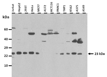 RPS9 Rabbit Polyclonal Antibody