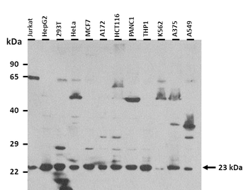 RPS9 Rabbit Polyclonal Antibody