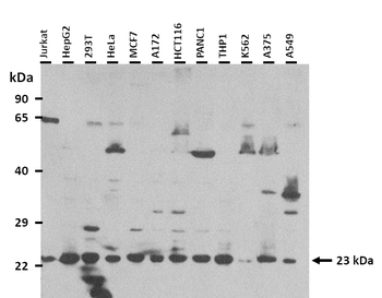 RPS9 Rabbit Polyclonal Antibody
