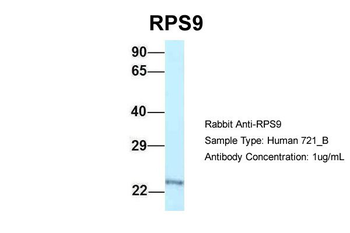 RPS9 Rabbit Polyclonal Antibody