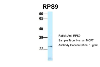 RPS9 Rabbit Polyclonal Antibody