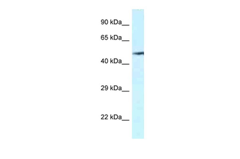 VNN2 Rabbit Polyclonal Antibody