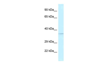 ALKBH1 Rabbit Polyclonal Antibody