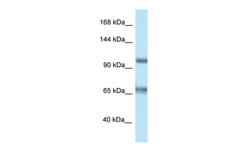 CARD10 Rabbit Polyclonal Antibody