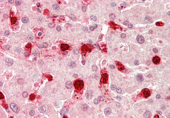 TOM1L1 Rabbit Polyclonal Antibody