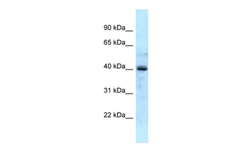 GALK1 Rabbit Polyclonal Antibody