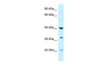 GALK1 Rabbit Polyclonal Antibody