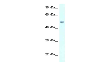 AMY2B Rabbit Polyclonal Antibody