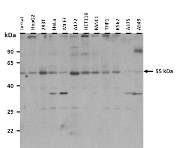 POLG2 Rabbit Polyclonal Antibody