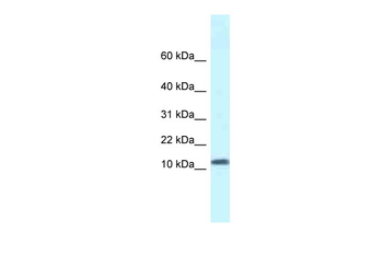 SSBP1 Rabbit Polyclonal Antibody