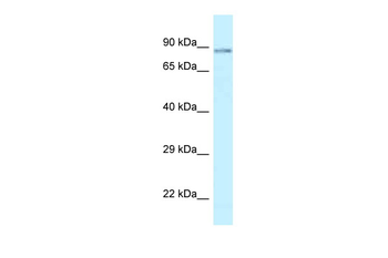 SCYL1 Rabbit Polyclonal Antibody
