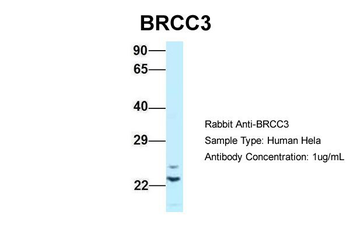 BRCC3 Rabbit Polyclonal Antibody