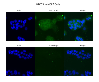 BRCC3 Rabbit Polyclonal Antibody