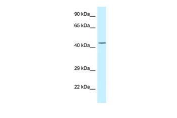DUSP9 Rabbit Polyclonal Antibody