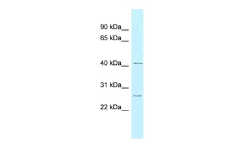 CCNK Rabbit Polyclonal Antibody